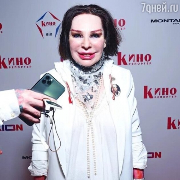 Ольга Медынич и другие российские звезды, которых обвинили в злоупотреблении инъекциями красоты