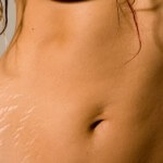 Растяжки на теле после беременности