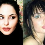 Самые большие губы в мире