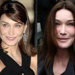 Жертвы пластической хирургии: Карла Бруни