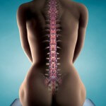 Как исправить осанку в домашних условиях