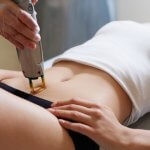 Лазерная эпиляция: часто задаваемые вопросы. Преимущества