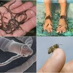 Самые «отвратительные» косметические процедуры