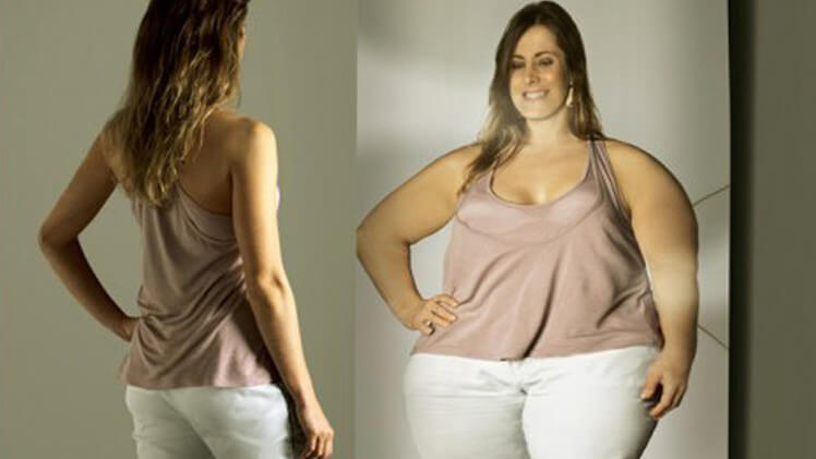 Вся правда о дисморфофобии