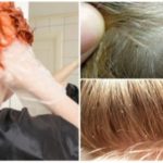 Можно ли вывести вшей путем окрашивания