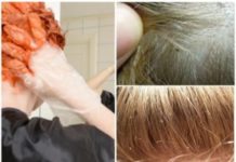 Можно ли вывести вшей путем окрашивания