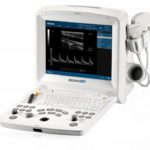 Виды УЗИ аппаратов