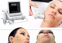 SMAS и RF лифтинг лица современными методами в Idelis