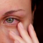 Покраснение глаз: основные причины появления дискомфорт