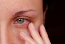 Покраснение глаз: основные причины появления дискомфорт