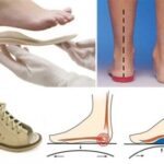 Как правильно выбрать правильную ортопедическую обувь?