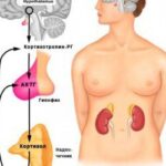 Кортизоловый стресс