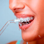 Ирригатор для зубов – что это за устройство?