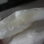 Выделения при беременности у женщин