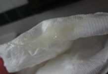 Выделения при беременности у женщин