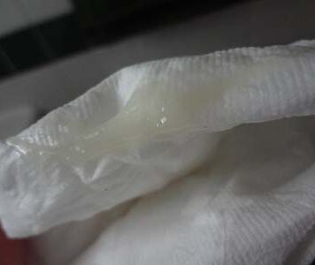 Выделения при беременности у женщин