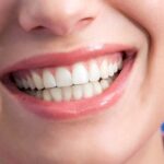 Пластика десны: как проходит операция?