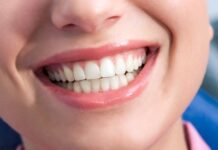 Пластика десны: как проходит операция?