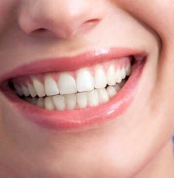 Пластика десны: как проходит операция?