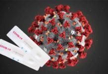 Что делать у кого положительный результат на коронавирус или кто находится в тесном контакте?