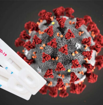 Что делать у кого положительный результат на коронавирус или кто находится в тесном контакте?