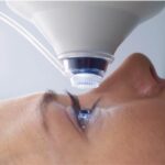 Лазерная коррекция зрения: какой метод лучше выбрать?