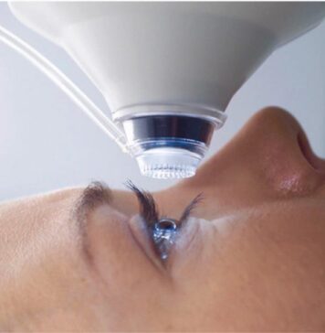 Лазерная коррекция зрения: какой метод лучше выбрать?