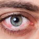 Распространенные болезни глаз