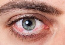 Распространенные болезни глаз