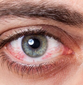 Распространенные болезни глаз