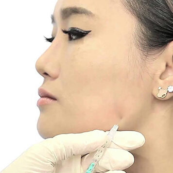 Ботокс в жевательные мышцы: эффективная коррекция линии челюсти, скул и щёк