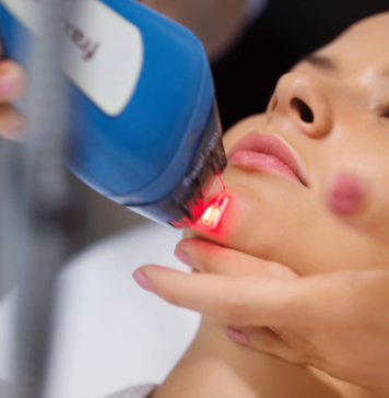 Особенности лазерного лечения акне