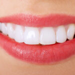 Топ 10 звезд российского шоубиза, поставивших виниры