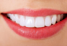 Топ 10 звезд российского шоубиза, поставивших виниры