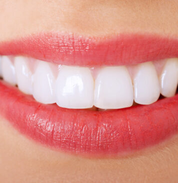 Топ 10 звезд российского шоубиза, поставивших виниры