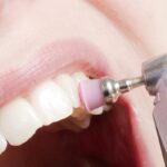 Что представляет собой ультразвуковая чистка зубов?