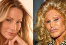 Неудачная пластика звезд