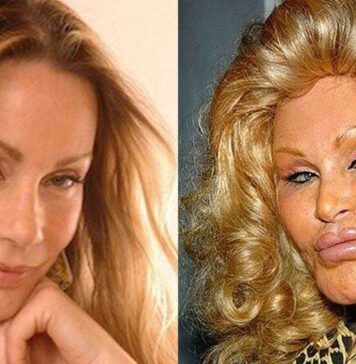 Неудачная пластика звезд