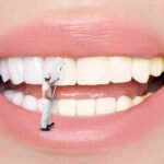 Художественная реставрация зубов: в чем преимущества этой процедуры?