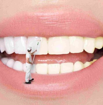 Художественная реставрация зубов: в чем преимущества этой процедуры?