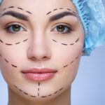 Особенности и виды пластики на лице