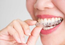 Элайнеры: эффективное исправление прикуса