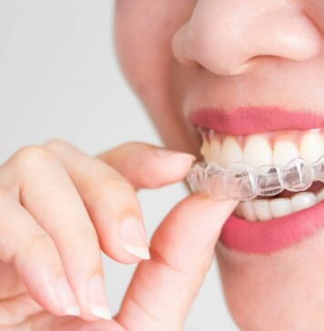 Элайнеры: эффективное исправление прикуса