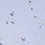 МАР-Тест: революционная диагностика в борьбе с бесплодием