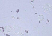 МАР-Тест: революционная диагностика в борьбе с бесплодием