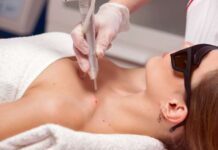 Удаление папиллом методом деструкции: исцеляющие шаги в уходе за кожей