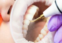 Ультразвуковая чистка зубов: эффективность и преимущества перед традиционными методами