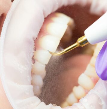 Ультразвуковая чистка зубов: эффективность и преимущества перед традиционными методами