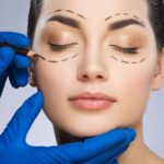 Как проходит блефаропластика верхних век?