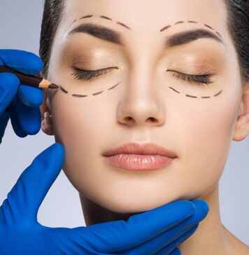 Как проходит блефаропластика верхних век?